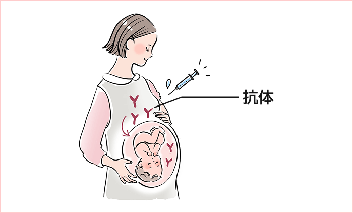 アブリスボとは